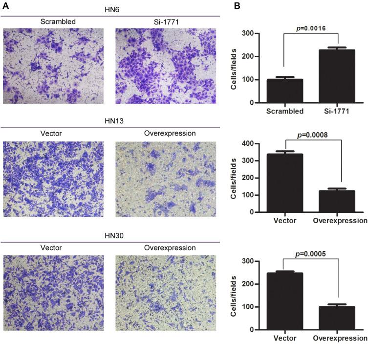https://cdn.ncbi.nlm.nih.gov/pmc/blobs/0e20/7320891/f24294c284f6/CMAR-12-4855-g0004.jpg