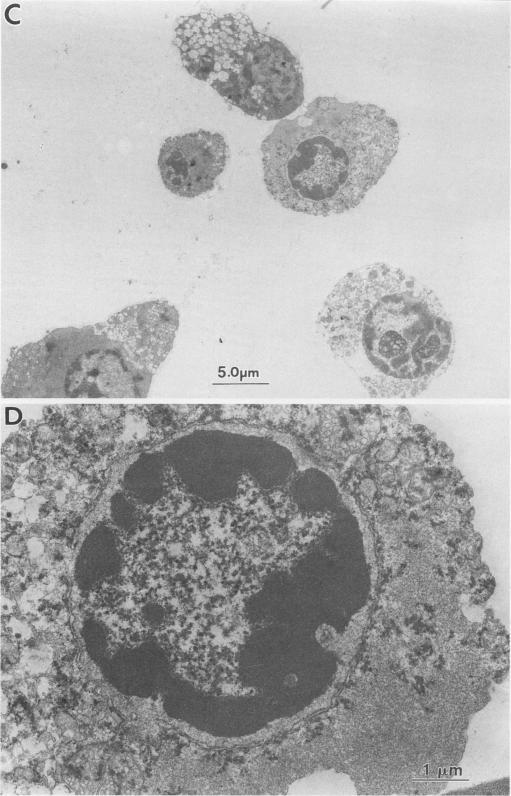 https://cdn.ncbi.nlm.nih.gov/pmc/blobs/0e21/236299/5fa6b8a0c3cf/jvirol00010-0419-a.jpg