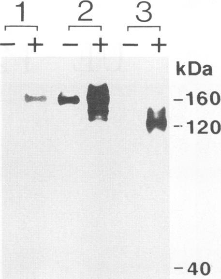 https://cdn.ncbi.nlm.nih.gov/pmc/blobs/0e21/236299/7e36ae344f2a/jvirol00010-0415-a.jpg