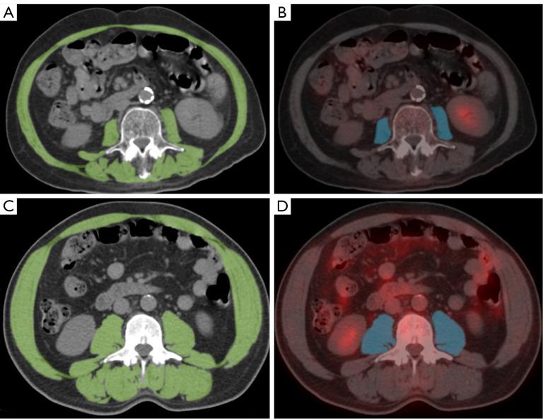 https://cdn.ncbi.nlm.nih.gov/pmc/blobs/0e2a/11485386/1759f396a97e/qims-14-10-7098-f2.jpg