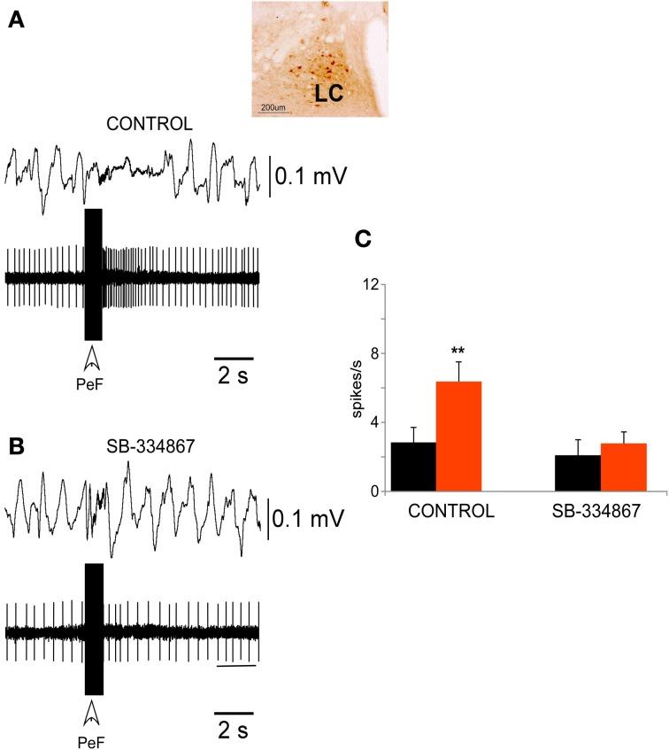 https://cdn.ncbi.nlm.nih.gov/pmc/blobs/0e2d/3832796/b77079c91ea7/fnins-07-00216-g0003.jpg