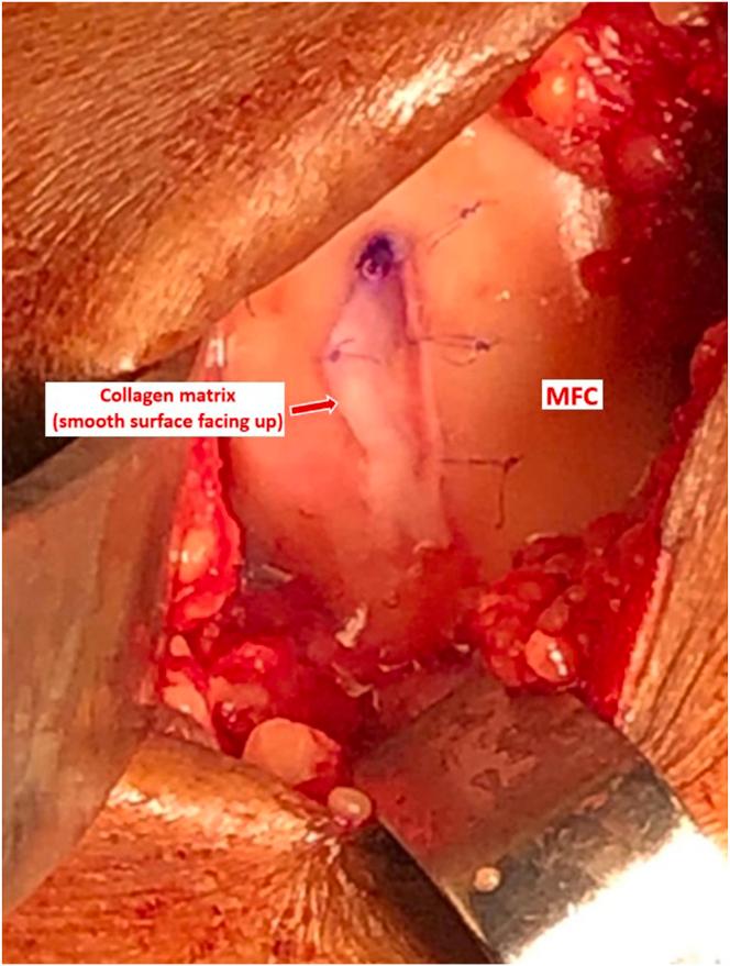 https://cdn.ncbi.nlm.nih.gov/pmc/blobs/0e3e/11977164/30627967297f/gr6.jpg
