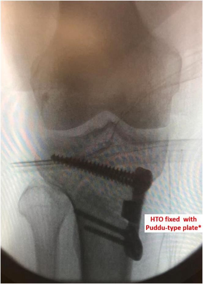 https://cdn.ncbi.nlm.nih.gov/pmc/blobs/0e3e/11977164/71be40030a7e/gr3.jpg