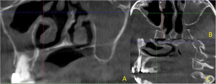 https://cdn.ncbi.nlm.nih.gov/pmc/blobs/0e3f/8278720/df01785611d2/13005_2021_284_Fig1_HTML.jpg