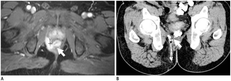 https://cdn.ncbi.nlm.nih.gov/pmc/blobs/0e45/4248626/0b873cba4903/kjr-15-712-g007.jpg