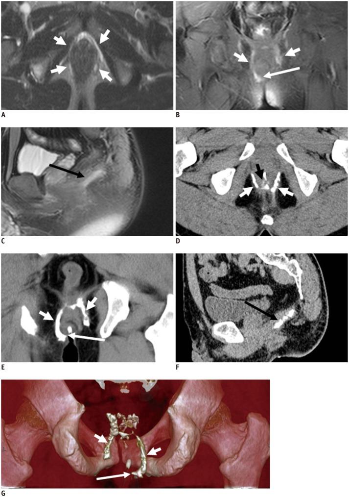 https://cdn.ncbi.nlm.nih.gov/pmc/blobs/0e45/4248626/323b6382934e/kjr-15-712-g008.jpg