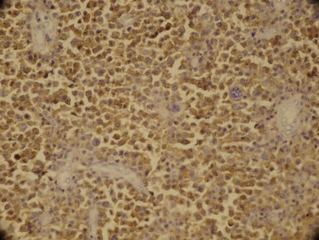 https://cdn.ncbi.nlm.nih.gov/pmc/blobs/0e4a/3785915/beaae436684b/ircmj-15-363-g003.jpg