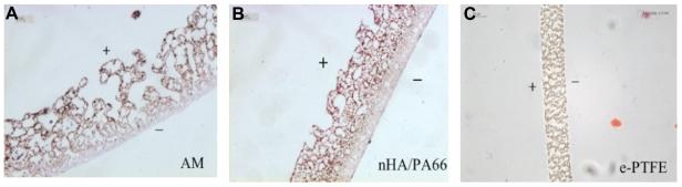 https://cdn.ncbi.nlm.nih.gov/pmc/blobs/0e4c/3173048/9c034157fd97/ijn-6-1853f1.jpg