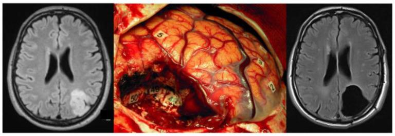 https://cdn.ncbi.nlm.nih.gov/pmc/blobs/0e4d/9032126/36fc81b54b16/brainsci-12-00504-g001.jpg