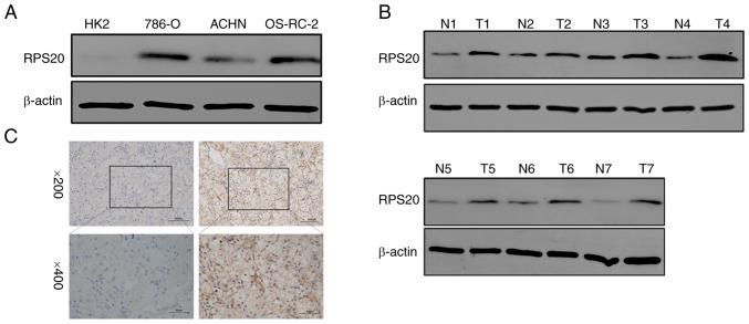 https://cdn.ncbi.nlm.nih.gov/pmc/blobs/0e51/9773015/1029145c2936/or-49-01-08459-g03.jpg