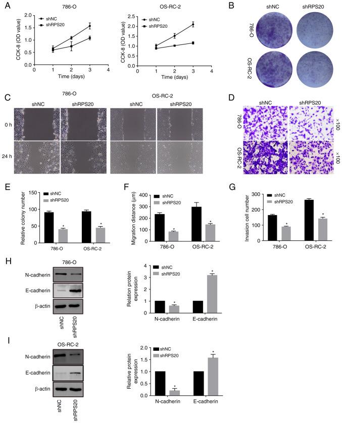 https://cdn.ncbi.nlm.nih.gov/pmc/blobs/0e51/9773015/f61396bb60d3/or-49-01-08459-g05.jpg