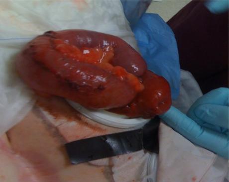 https://cdn.ncbi.nlm.nih.gov/pmc/blobs/0e59/2908664/ab07b907d340/wjem-11-214f1.jpg