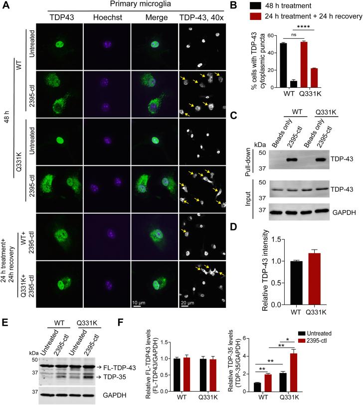 https://cdn.ncbi.nlm.nih.gov/pmc/blobs/0e65/11719319/8d3d2f67cc66/gr8.jpg