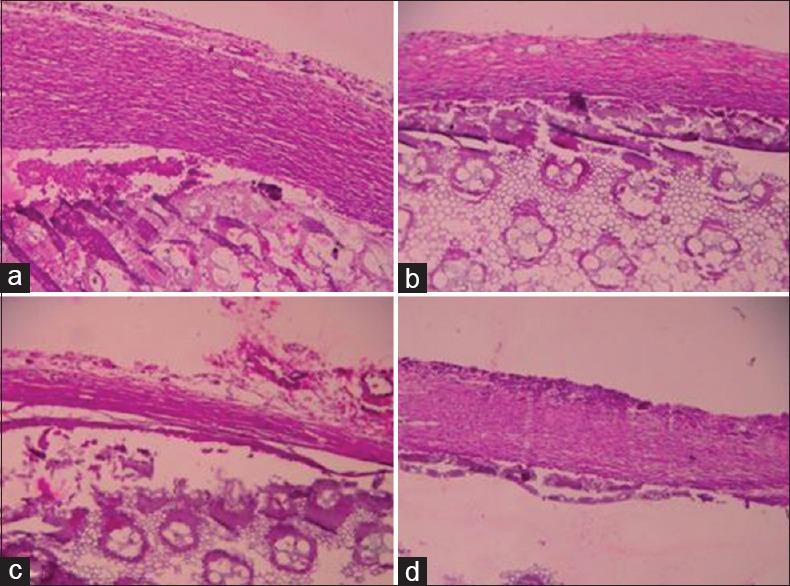 https://cdn.ncbi.nlm.nih.gov/pmc/blobs/0e6d/5327602/99a65f405339/IJABMR-7-26-g006.jpg