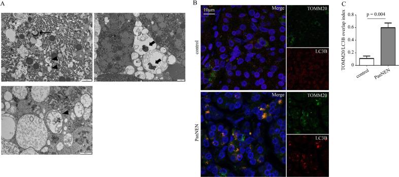 https://cdn.ncbi.nlm.nih.gov/pmc/blobs/0e6e/7266843/706adc13c620/12020_2020_2228_Fig3_HTML.jpg