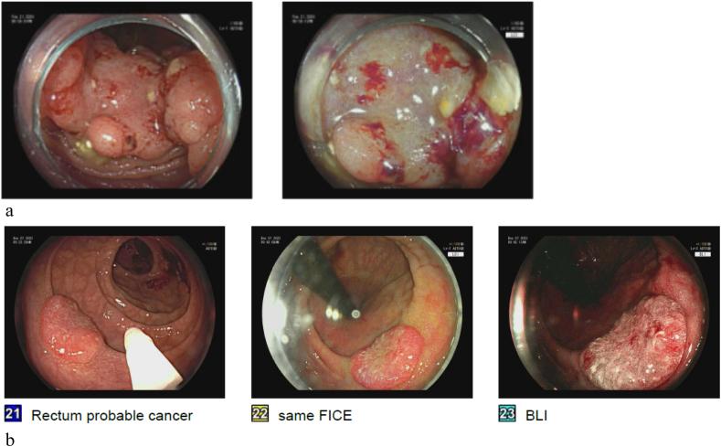 https://cdn.ncbi.nlm.nih.gov/pmc/blobs/0e6f/11296069/5acdd1315e34/gr3.jpg