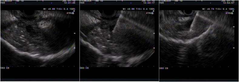 https://cdn.ncbi.nlm.nih.gov/pmc/blobs/0e6f/11296069/b26a8aa5c383/gr15.jpg