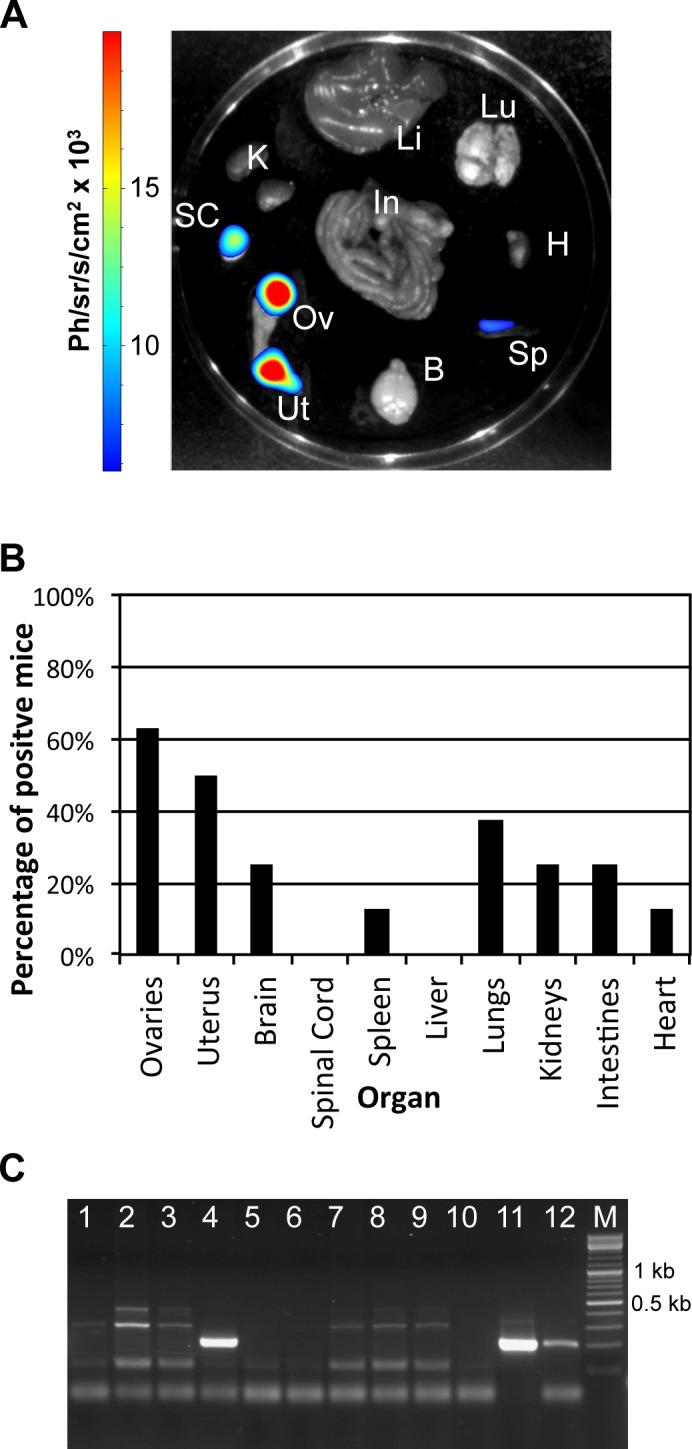 https://cdn.ncbi.nlm.nih.gov/pmc/blobs/0e6f/4703293/f533eb43364c/pntd.0004350.g003.jpg
