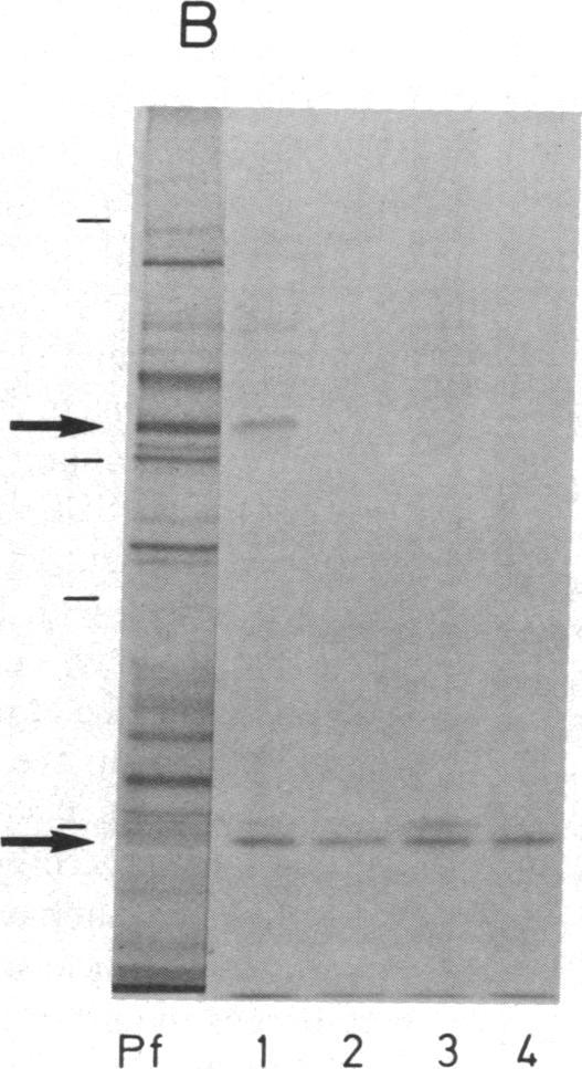 https://cdn.ncbi.nlm.nih.gov/pmc/blobs/0e79/425516/ca00b503e1f7/jcinvest00140-0337-b.jpg
