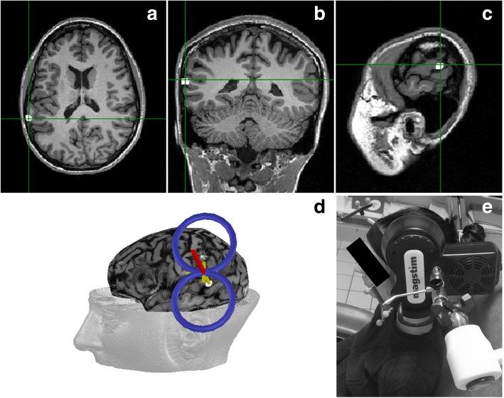 https://cdn.ncbi.nlm.nih.gov/pmc/blobs/0e8a/6480831/5dd17ce6c54f/13063_2019_3311_Fig3_HTML.jpg