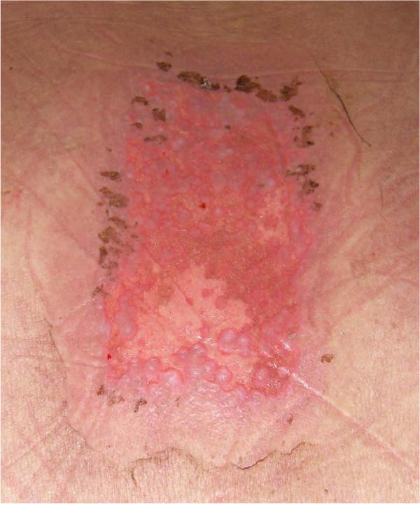 https://cdn.ncbi.nlm.nih.gov/pmc/blobs/0e8e/2894848/85c559bd7167/1748-717X-5-49-3.jpg