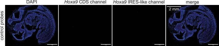https://cdn.ncbi.nlm.nih.gov/pmc/blobs/0e92/12048685/fa16440c6293/44318_2025_404_Fig10_ESM.jpg