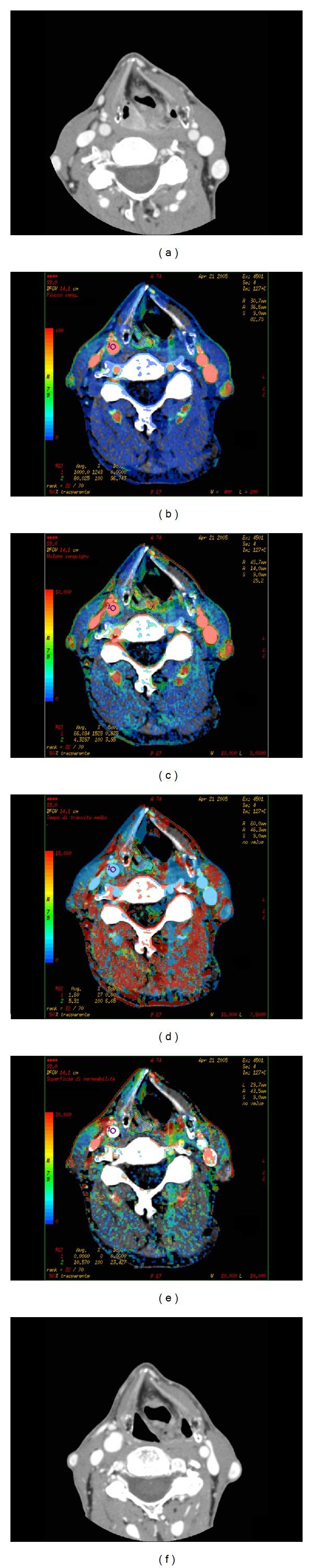 https://cdn.ncbi.nlm.nih.gov/pmc/blobs/0e98/4129140/0f4310570902/BMRI2014-917150.001.jpg