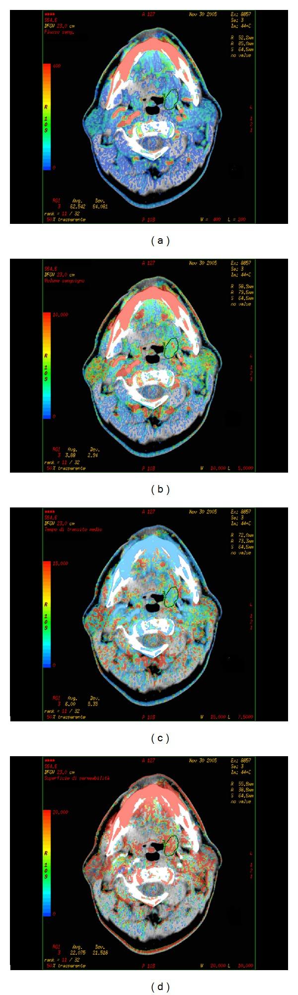 https://cdn.ncbi.nlm.nih.gov/pmc/blobs/0e98/4129140/b8bac0b43efd/BMRI2014-917150.002.jpg