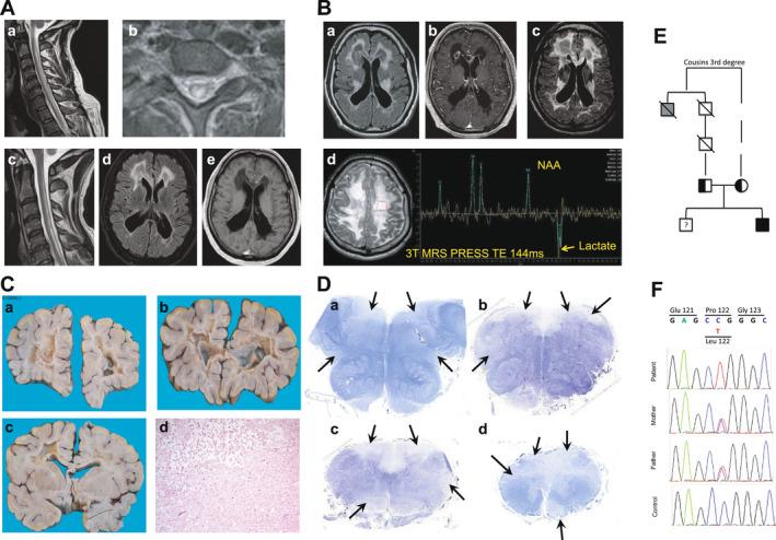 https://cdn.ncbi.nlm.nih.gov/pmc/blobs/0e98/9186134/3adfca4649b7/ACN3-9-888-g001.jpg