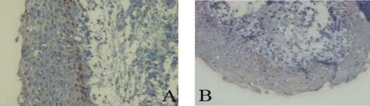 https://cdn.ncbi.nlm.nih.gov/pmc/blobs/0ea3/3927379/8374a54b2550/ijmcm-2-185-g004.jpg