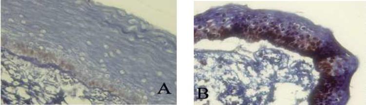 https://cdn.ncbi.nlm.nih.gov/pmc/blobs/0ea3/3927379/c437bda414cc/ijmcm-2-185-g003.jpg