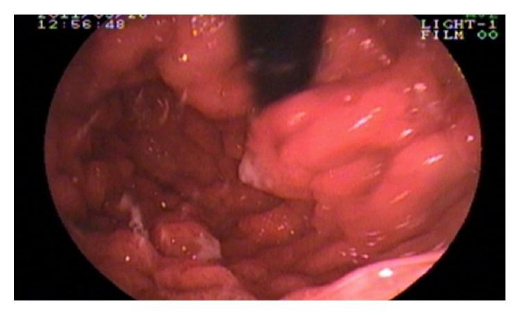 https://cdn.ncbi.nlm.nih.gov/pmc/blobs/0ea5/4749779/983a3e5d1a2d/CRIM2016-4210397.005.jpg