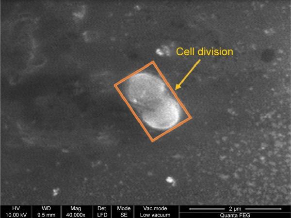 https://cdn.ncbi.nlm.nih.gov/pmc/blobs/0eb9/4599615/79cc0950aca9/ijn-10-189Fig9.jpg