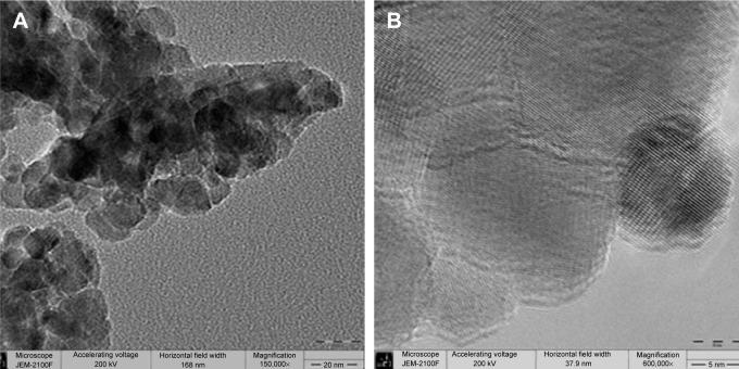 https://cdn.ncbi.nlm.nih.gov/pmc/blobs/0eb9/4599615/a345a3656cd1/ijn-10-189Fig6.jpg