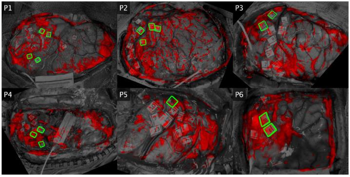 https://cdn.ncbi.nlm.nih.gov/pmc/blobs/0ebc/10377735/d50c6e670d20/brainsci-13-01091-g005.jpg