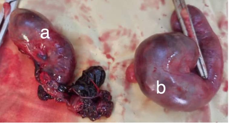 https://cdn.ncbi.nlm.nih.gov/pmc/blobs/0ebc/12305758/86e56aed4b67/bcr-18-7-g003.jpg