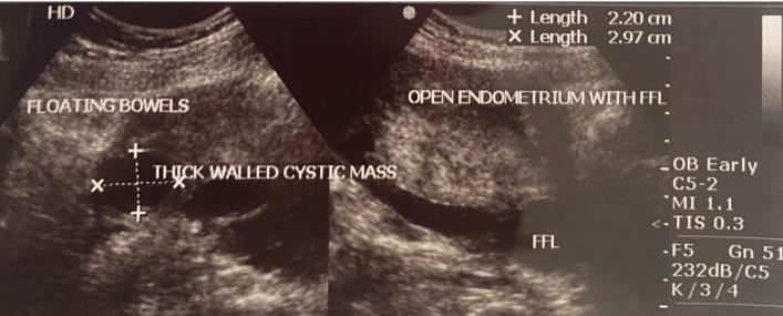 https://cdn.ncbi.nlm.nih.gov/pmc/blobs/0ebc/12305758/9a5ed22065db/bcr-18-7-g001.jpg