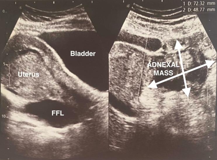 https://cdn.ncbi.nlm.nih.gov/pmc/blobs/0ebc/12305758/9c2c3d3afe23/bcr-18-7-g002.jpg
