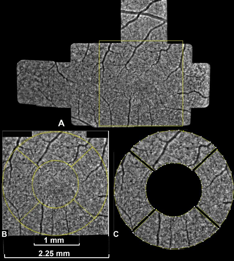 https://cdn.ncbi.nlm.nih.gov/pmc/blobs/0ec3/10214881/d3399a382272/iovs-64-5-23-f002.jpg