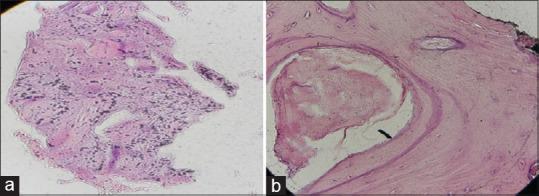 https://cdn.ncbi.nlm.nih.gov/pmc/blobs/0ecf/10028575/606796d5e112/DRJ-20-26-g006.jpg