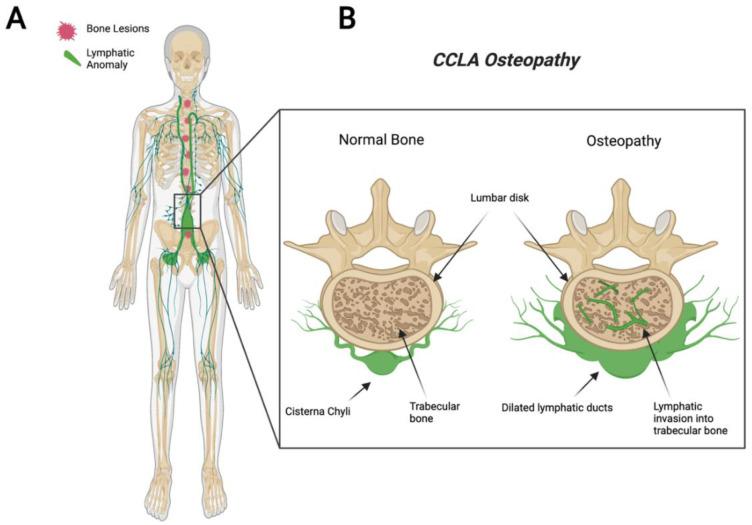 https://cdn.ncbi.nlm.nih.gov/pmc/blobs/0ed4/9332568/3885b3fe4ae6/ijms-23-08258-g003.jpg
