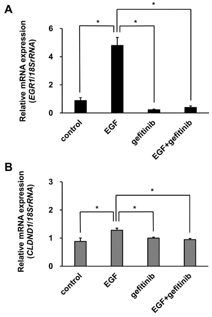 https://cdn.ncbi.nlm.nih.gov/pmc/blobs/0ed8/9329870/ecc353fdbcbb/biomedicines-10-01792-g006.jpg
