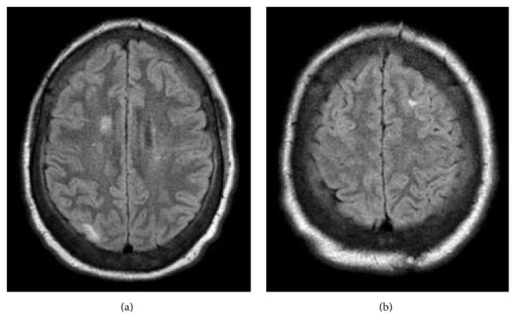 https://cdn.ncbi.nlm.nih.gov/pmc/blobs/0edc/4752974/278f6f866ccd/CRIRA2016-3750450.003.jpg