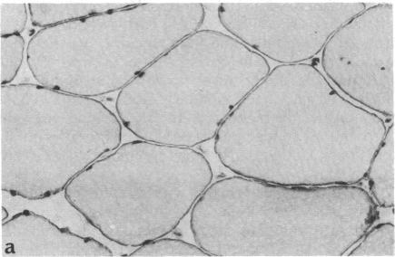 https://cdn.ncbi.nlm.nih.gov/pmc/blobs/0edf/344919/2332057f7980/pnas00604-0137-b.jpg