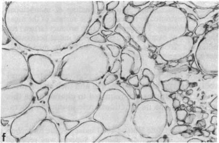 https://cdn.ncbi.nlm.nih.gov/pmc/blobs/0edf/344919/24200e83cd9a/pnas00604-0138-c.jpg