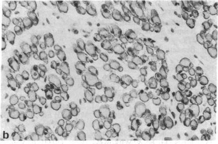 https://cdn.ncbi.nlm.nih.gov/pmc/blobs/0edf/344919/48ec40eb9c83/pnas00604-0138-d.jpg