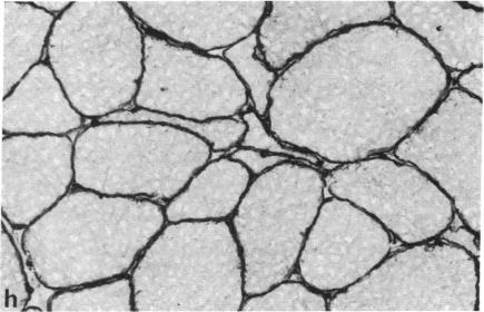 https://cdn.ncbi.nlm.nih.gov/pmc/blobs/0edf/344919/fd70a09365a8/pnas00604-0138-g.jpg