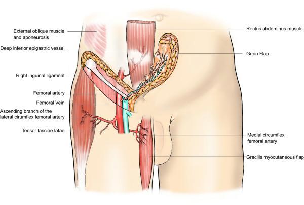 https://cdn.ncbi.nlm.nih.gov/pmc/blobs/0ee8/1097762/0c2e6220c3a4/1477-7819-3-23-5.jpg