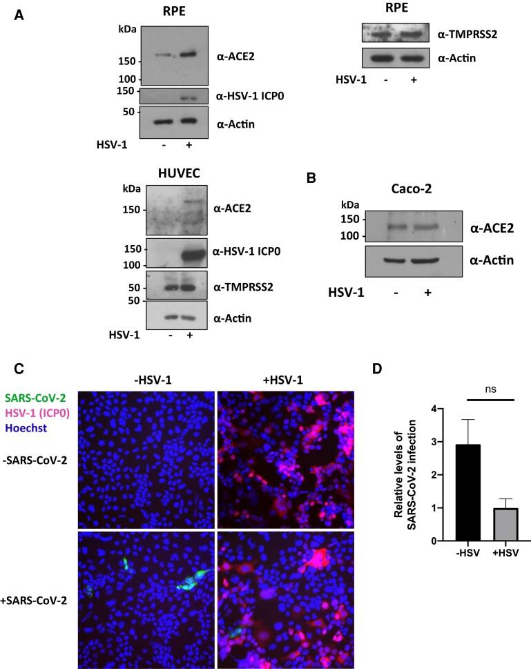 https://cdn.ncbi.nlm.nih.gov/pmc/blobs/0ee9/9927080/1bda213b7d69/jiac452f7.jpg