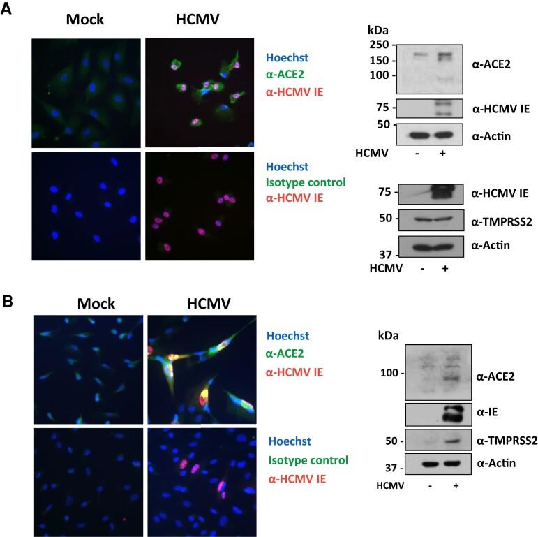 https://cdn.ncbi.nlm.nih.gov/pmc/blobs/0ee9/9927080/b51315ad794c/jiac452f4.jpg